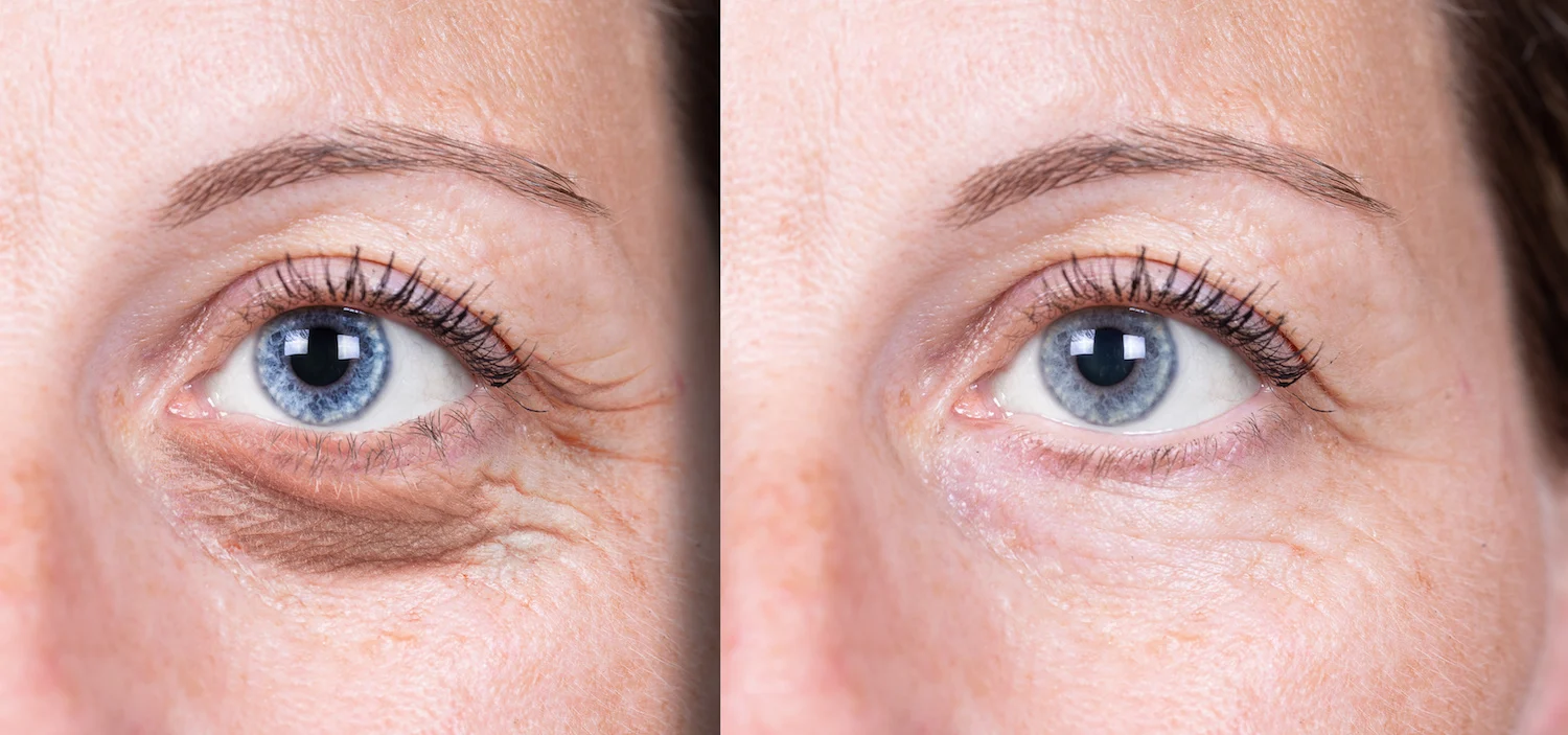 before-after